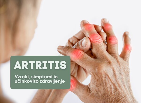 Artritis sklepov rok – otekli sklepi, bolečina in vnetje pri revmatoidnem artritisu