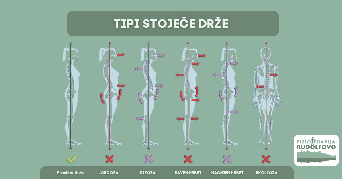 Tipi stoječe drže – primerjava pravilne drže z lordozo, kifozo, ravnim hrbtom, nagnjenim hrbtom in skoliozo