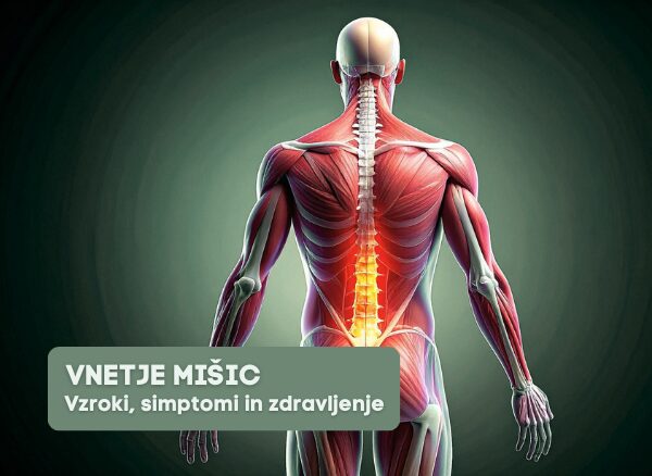 Vnetje mišic (miozitis) - anatomska ilustracija prizadetih hrbtnih in ledvenih mišic z označeno vnetno območje. Vzroki, simptomi in učinkovito zdravljenje vnetja mišic v Fizioterapiji Rudolfovo Novo mesto.